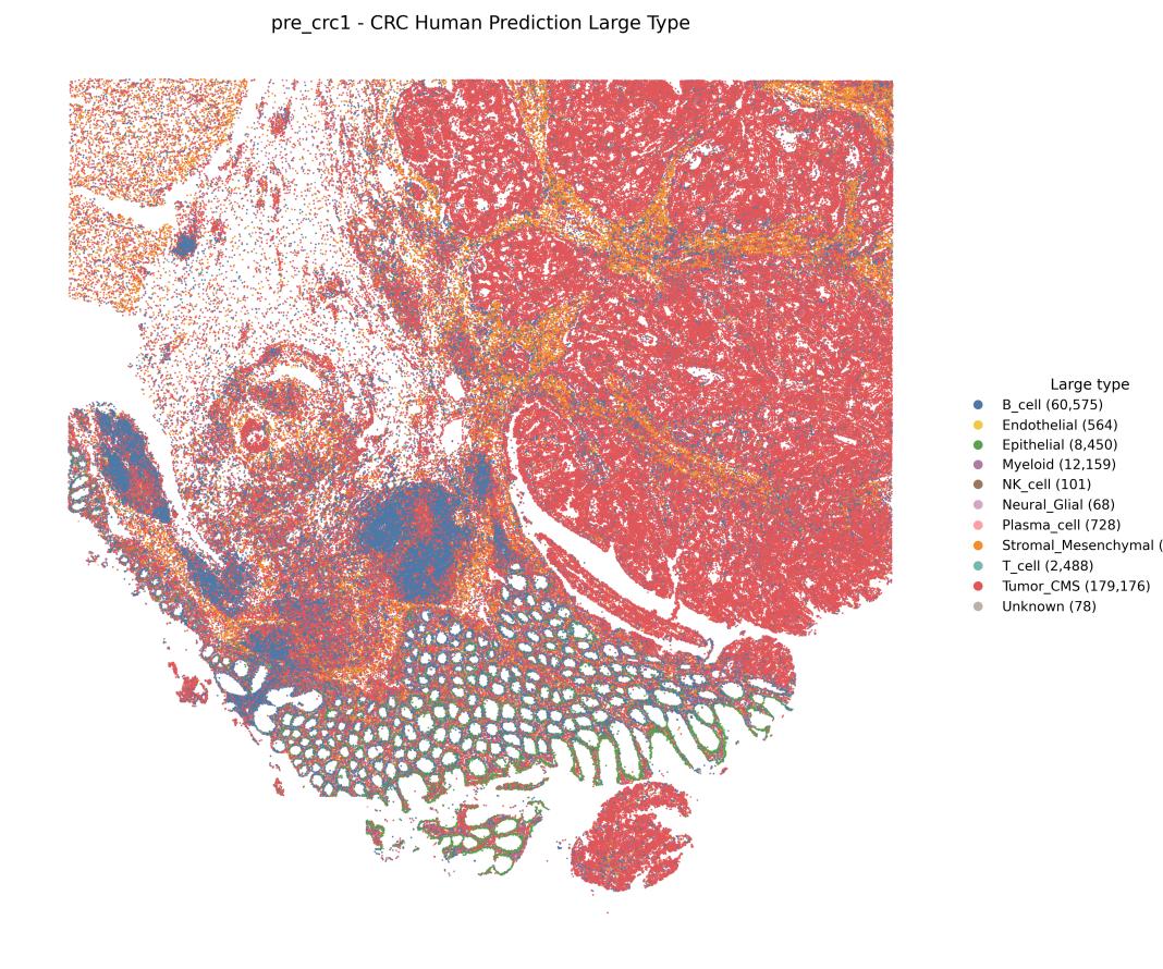 CRC spatial cell type prediction map